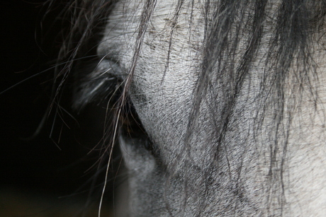 Eye