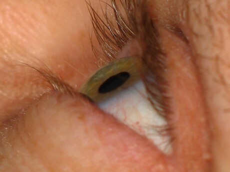 Die oog