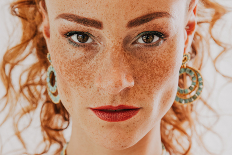 Freckles-By Martine van der Moolen-