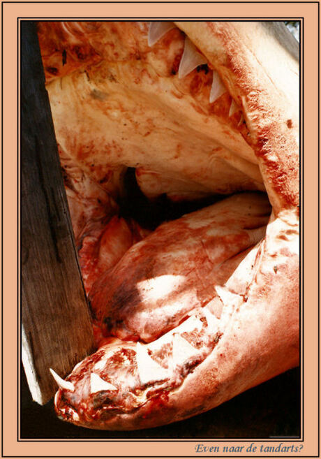 Even naar de tandarts